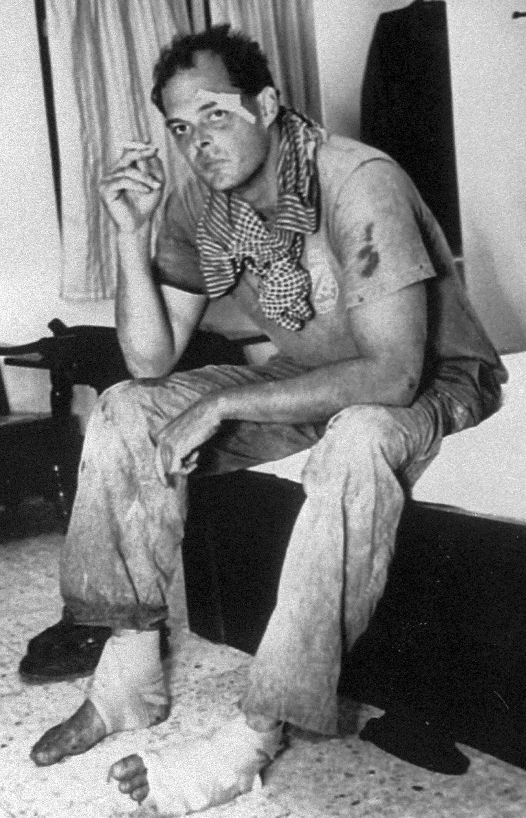 ENG_KHM_THAYER_Q&A_01072023.2.jpg American journalist Nate Thayer sits bandaged in a hotel room on Oct. 15, 1989 in Aranyaprathet, Thailand, after he was injured in a land mine explosion while returning from Cambodia. Credit: Associated Press