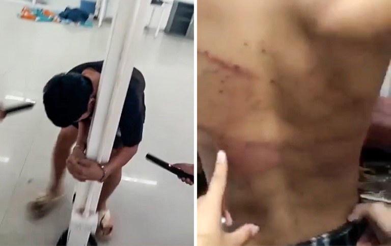A youth being forced to work at the Casino Kosai in Myanmar is tied to a column and tased [left]. Injuries to his back are seen at right. Credit: Screenshots from video provided to RFA