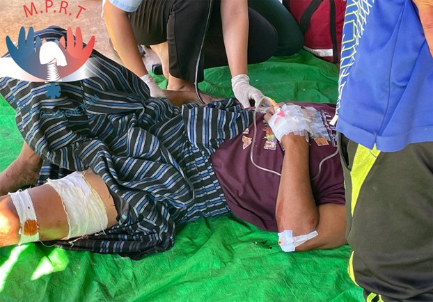 ENG_BUR_MoebyeDeaths_06122023_02.jpg A civilian who sustained injuries during shelling by Myanmar soldiers is treated in Moebye township, southeastern Myanmar's Kayah state, Jul. 26, 2022. Credit: Mobye PDF Rescue Team