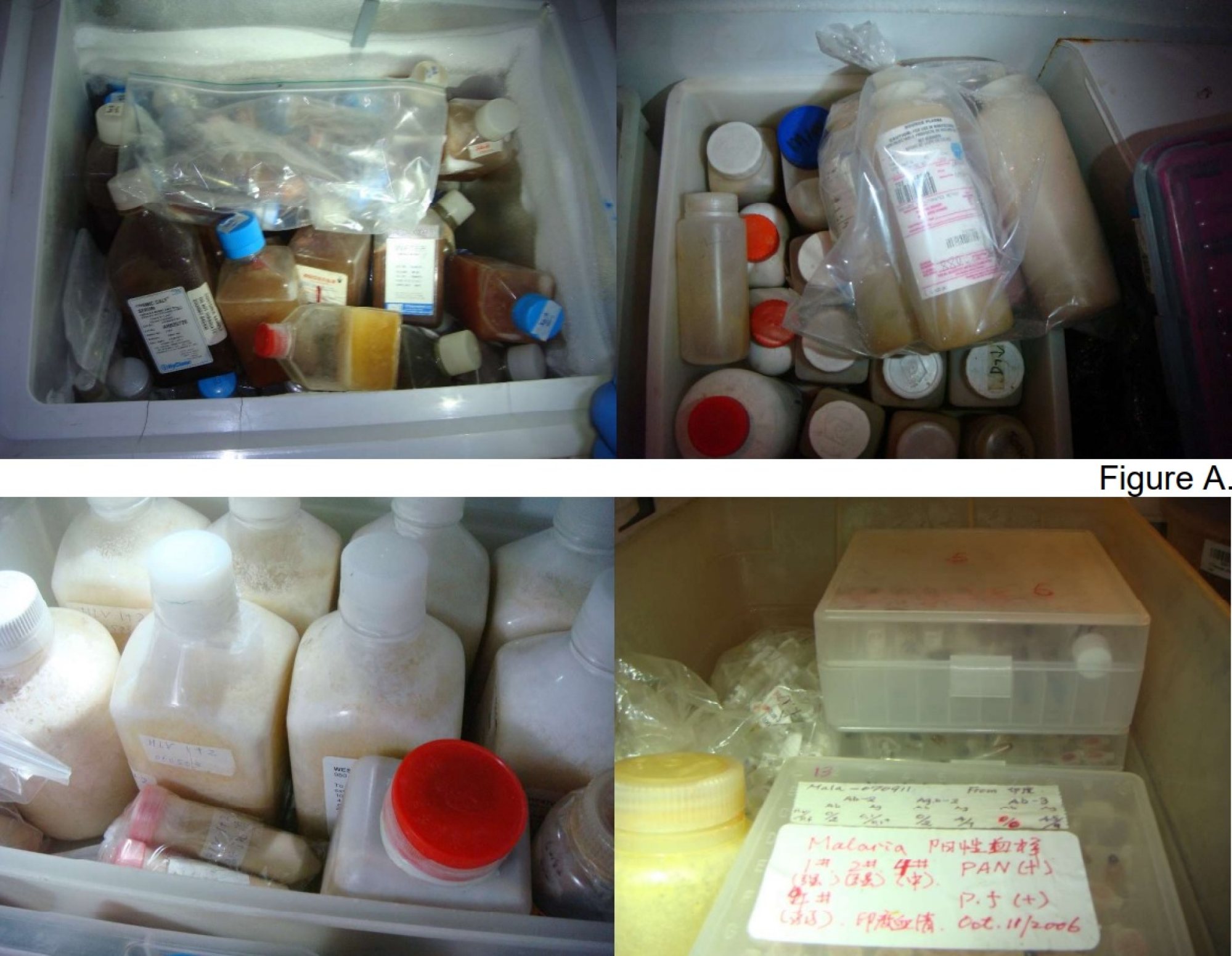 Medical items found by investigators in the refrigerators. Photo: Fresno County Department of Public Health unlicensed california lab housing pathogens tied to china firms us house panel concludes after subpoena 2