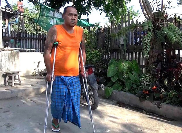 ENG_BUR_LandmineDangers_12282023.3.jpg Aik Pee, who lost his leg after stepping on a mine, is seen in Hsipaw in Myanmar's northern Shan state, Feb. 28, 2022. (RFA)