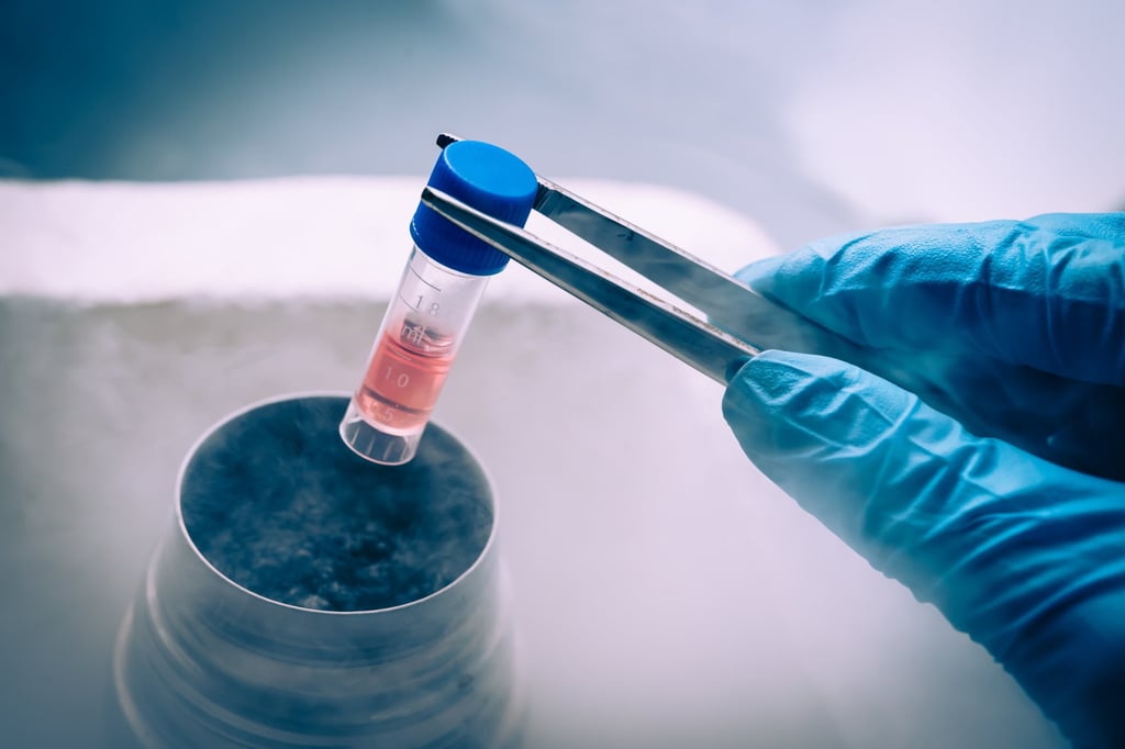 Research teams around the world are racing to develop cutting-edge treatments for Parkinson’s disease, with leading contenders mainly based in Japan, the United States and China. Photo: Shutterstock